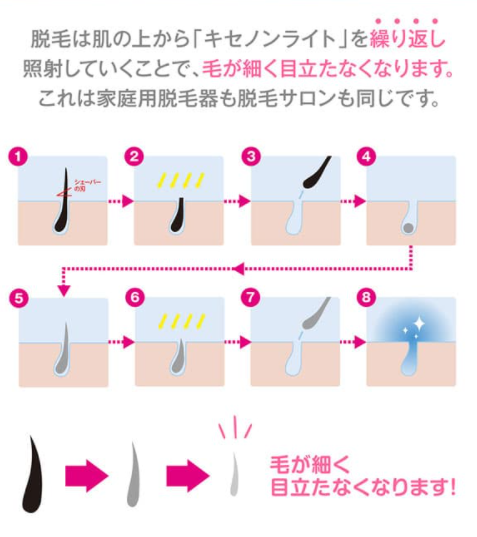 脱毛サイクルについて