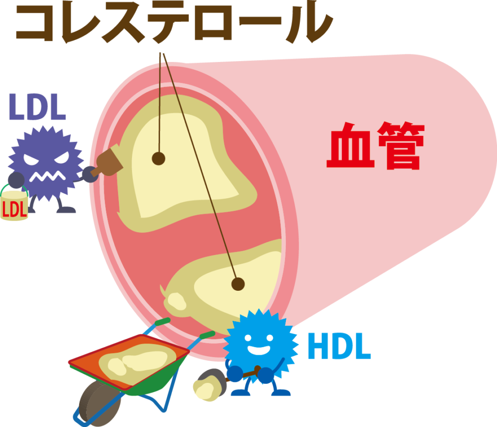 HDLコレステロールが低いと血管に悪影響が